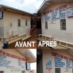 Avant apres centre 2